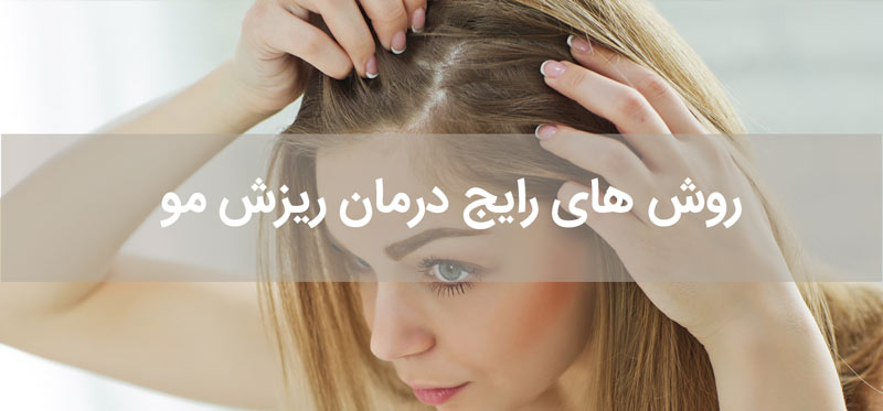 درمان ریزش مو به روش های مختلف و آشنایی با عوارض و ویژگی های هر کدام
