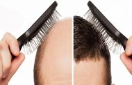 کاشت مو به چه صورتی انجام می شود و بهترین و جدیدترین روش های پیوند مو چگونه اند؟
