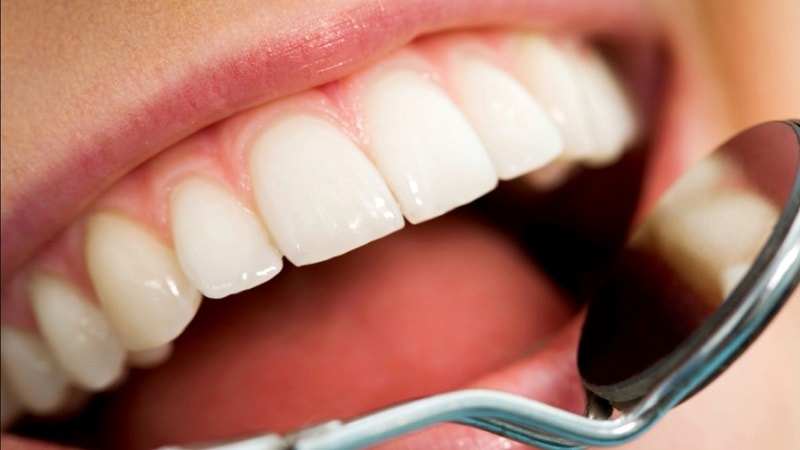 درمان های خانگی پوسیدگی دندان